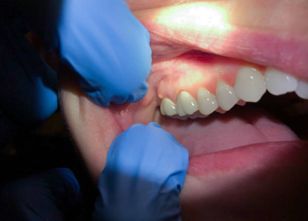 Best Emergency Gum Treatment in Prairie Heights, WA